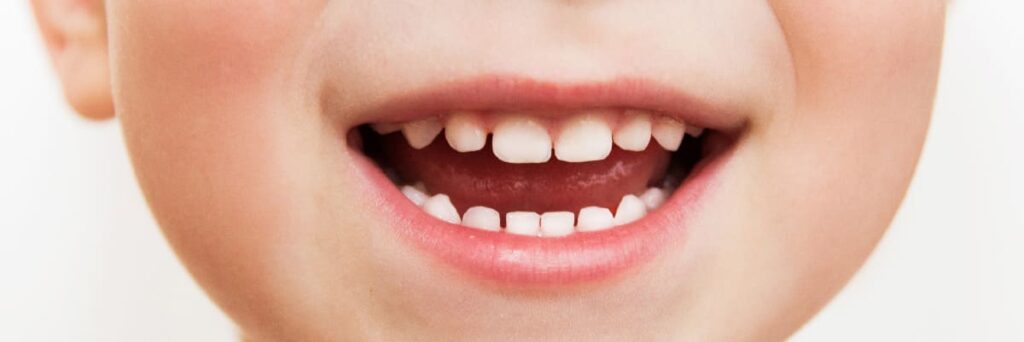 Pedodontie à Geneve Soins dentaires enfants