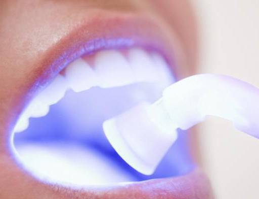 Conservative dental treatment in Geneva