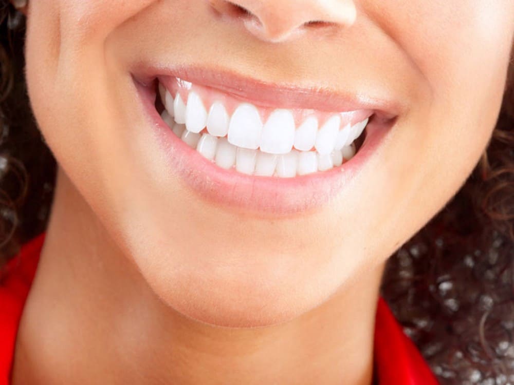 Photo of a smile