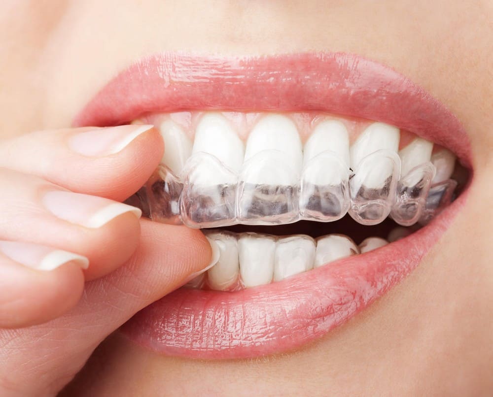 Orthodontie Genève